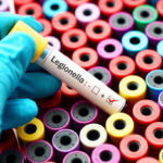 Do landlords have to test for Legionella?