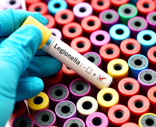 Do landlords have to test for Legionella?